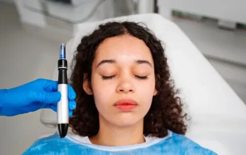 Microneedling Treatment Specialist in Nashik service image