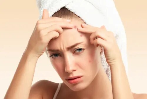 Acne & Acne Scar Treatment Specialist in Nashik service image