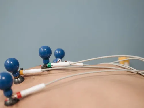ECG service image