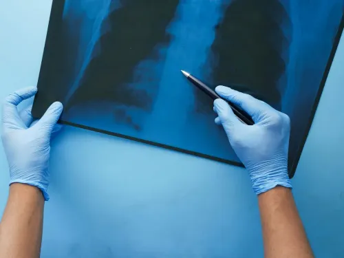 Pacemaker Implantation service image