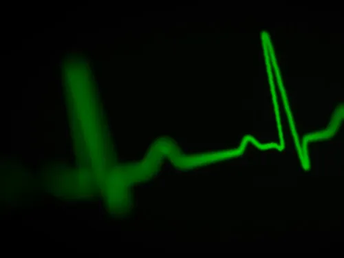 Arrhythmia Ablation service image