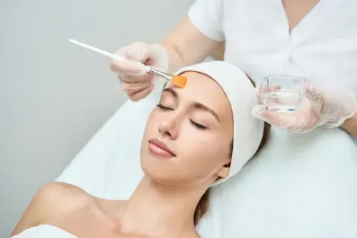 Chemical Peels service image