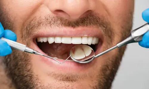 Gum Care / Periodontal Treatment service image