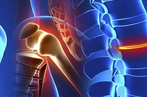 Complex Orthopedic Trauma Treatment service image