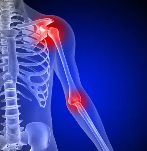 Shoulder and elbow surgery  service image