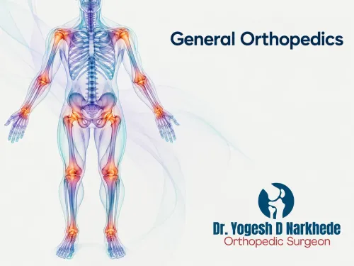 General Orthopedics service image