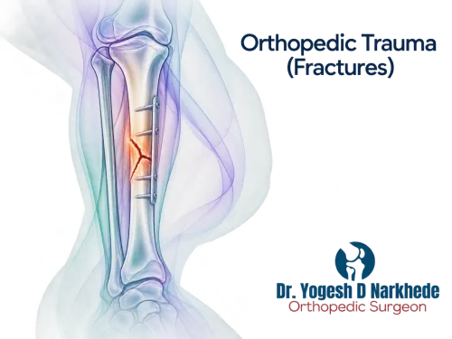 Orthopedic Trauma (Fractures) service image