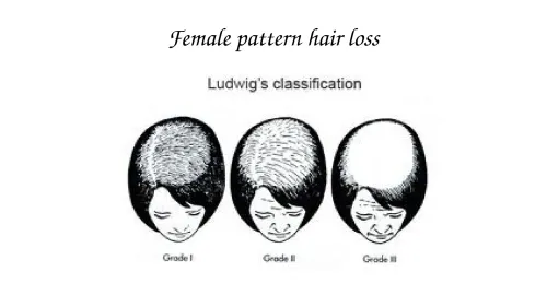 Female Hair Transplant service image