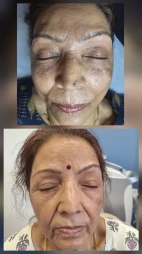 Combination Of Multiple Treatment  service image