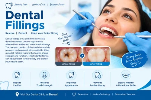 Dental Fillings
 service image