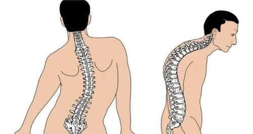 Spinal Deformities service image