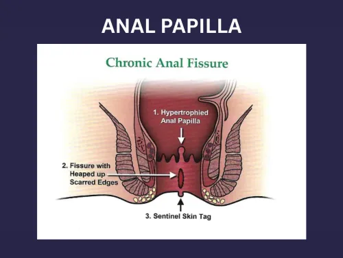 ANAL PAPILLA service image