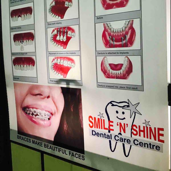 Braces