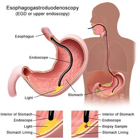 Endoscopy