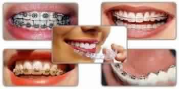 Orthodontics is the branch of 