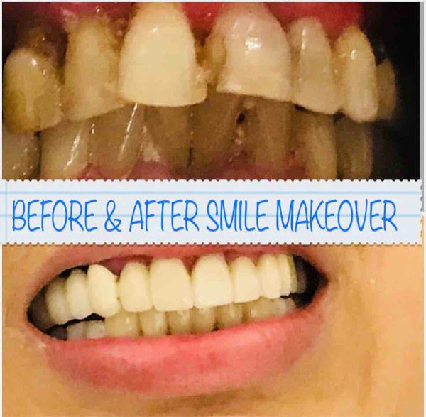 Cosmetic dentistry