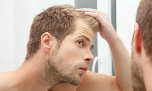 Male Hair Loss service image