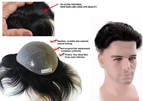  Non-Surgical Hair Replacement service image