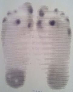 Foot scann