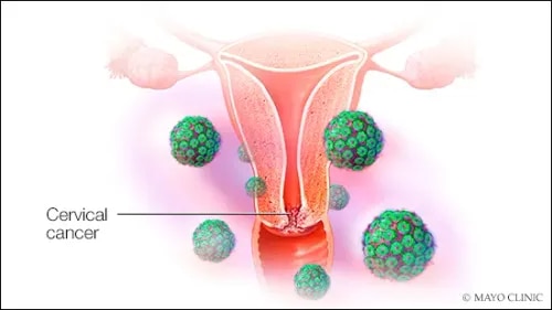 Cervical cancer Screening  & Immunization  service image