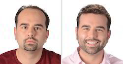 We are a trusted name engaged in offering an exclusive range of Hair Replacement. The offered hair is made by our highly experienced professionals using the best grade human hair. The provided hair is highly appreciated by our precious clients for its smooth finish and elegant look. Moreover, we provide this hair to our client’s at most affordable price.
Features:
Excellent sheen
Tangle free
Fits well