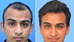 With the aid our highly professional team, we are pleased to offer our customers a wide range of Mens Hair Patch. As per the set industry standards, the offered hair patch is processed by our adroit professionals in hygienic conditions. In order to ensure its safe usage, the offered hair patch is stringently tested against various quality parameters. Our offered hair patch is broadly acclaimed in the market for its light weight, long lasting shine, and reasonable price.
Features:
No shedding weft
Smooth and silky
Natural in look and shine