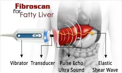 Liver Fibroscan service image