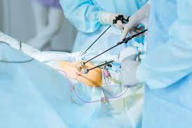 Laparoscopy is a surgical proc