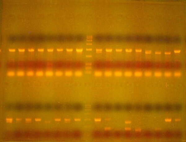 PCR, RFLP, RAPD, Primer design, etc