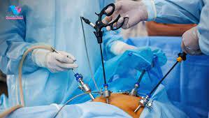 Laparoscopic surgery