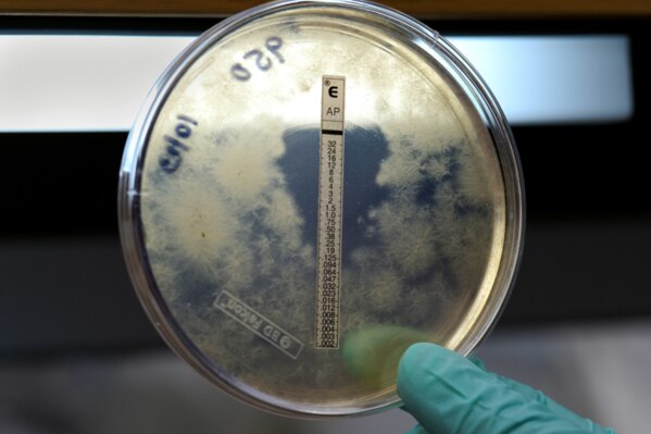 We provide an all type of Microbiology Services.