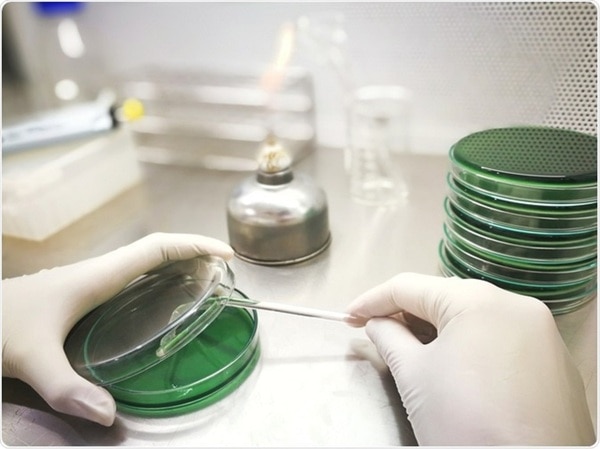 We provide Microbial limit test, colony counting, MBC, the percentage reduction of the microbial count of finished products, raw materials, plant extracts, new plant for formulations, food items, synthetic drugs, etc