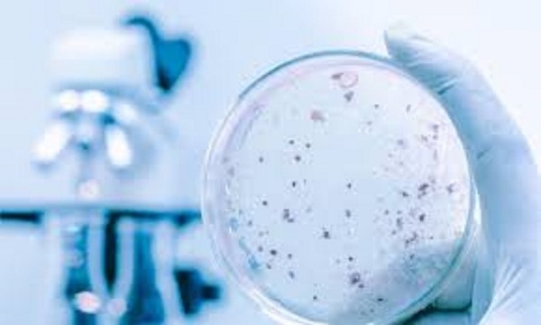We provide an Bacteriological Testing Service