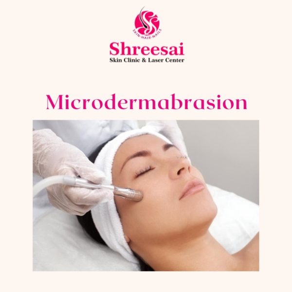 Microdermabrasion is a minimal