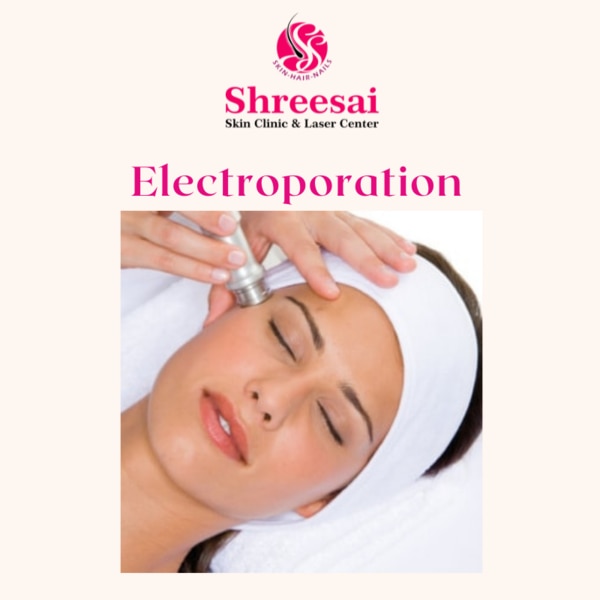 Electroporation makes use of e