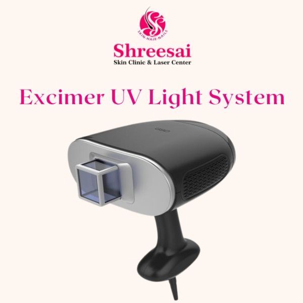 Excimer light treatm