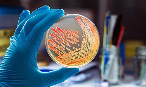 MICROBIOLOGICAL ANALYSIS & SERVICES
MICROBIOLOGICAL ANALYSIS & SERVICES
Manufacturing food, pharmaceutical and cosmetics products are necessary to undergo microbiological screening to guarantee the quality and composition of products. Hence, the microbiological tests are carried out throughout the production process to ensure the absence of pathogenic bacteria. Synthesis Lab Technology offers microbiological testing assays for agriculture, foods, antibiotics, vitamins, pharmaceutical and cosmetics industries, in the following areas: food safety, quality control, traceability, sterility, water and air.
PARAMETERS
• Enumeration of microorganisms – Total Aerobic Microbial Count/Aerobic Plate Count/Total Plate Count/ Standard Plate Count/ Total Bacterial Count
• Total coliform
• Escherichia coli
• Salmonella spp.
• Shigella spp.
• Staphylococcus aureus
• Bacillus cereus
• Clostridium perfringens
• Enterobacteriaceae
• Sulphite reducing bacteria
• Faecal Streptococci
• Listeria monocytogenes
• Thermophilic bacteria
• Thermoduric bacteria
• Lactic acid bacteria
• Yeast and mold count
SURVEY PROCEDURES
• Operation Theatre (Microbial -Contamination Level)
• Pharma Industries
• Clean Room Facility
• Restaurants
• Kitchen
• Food Manufacturing facility
• Drug Manufacturing facility
• Bio-burden analysis
• Contact plate analysis`