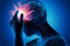 Migraine is a type of headache characterized by recurrent attacks of moderate to severe throbbing and pulsating pain on one side of the head.