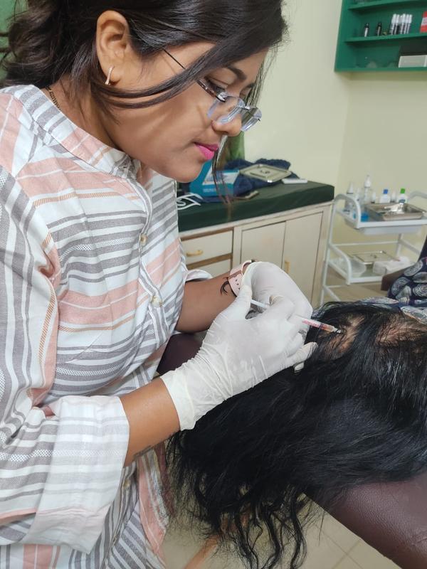 PRP therapy is the best treatment for your hairloss or baldness..