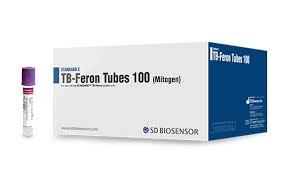 STANDARD E TB-Feron ELISA