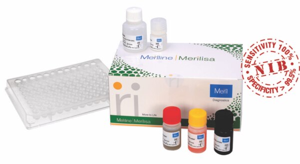 HIV 1-2 Gen 33