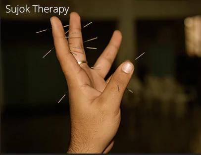 Sujok Therapy