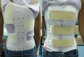 Product Overview:The Orthopedic Scoliosis Brace from Orthotech Appliances is a highly effective solution for individuals suffering from scoliosis or abnormal curvature of the spine. Designed to provide spinal stabilization and prevent further progression of spinal deformities, this brace plays a crucial role in the management of scoliosis in both adolescents and adults. It helps reduce pain, improve posture, and prevent worsening of the condition, ensuring better quality of life for individuals undergoing scoliosis treatment.Key Features:Customizable Support & Fit:The Orthopedic Scoliosis Brace is made from lightweight, durable materials that offer a high degree of adjustability, ensuring a secure and comfortable fit for different body types.Corrective Spinal Alignment:Designed to apply pressure at specific points on the body, the brace gently encourages the spine to align correctly and prevents further curvature, supporting effective treatment and management.Comfortable Design for Daily Use:The brace is designed to be worn throughout the day without causing discomfort. With its breathable material and ergonomic structure, it ensures that users can go about their day-to-day activities with ease.Pain Reduction:The brace helps in reducing the pain associated with scoliosis by providing added support and stability to the spine. It helps in relieving muscle strain caused by abnormal spinal curves.Durable & Lightweight Construction:Constructed with high-quality materials, the brace is both durable and lightweight, making it easy to wear for extended periods without causing discomfort or irritation.Easy to Wear & Adjust:The brace is user-friendly, with adjustable straps that make it simple to put on, take off, and modify for a more precise fit.Indications:Mild to moderate scoliosisPostural correction for children and adults with scoliosisPrevention of further spinal curvature progressionPain management for scoliosis patientsSpinal support during scoliosis treatmentWhy Choose Orthotech Appliances?Trusted Expertise: At Orthotech Appliances, we are committed to providing patients with high-quality, reliable orthopedic solutions tailored to their needs.Personalized Care: Our team of experts is always available to provide guidance on the best treatment options and help fit you with the most effective brace for your condition.Convenient Location: Located in Laxmi Nagar, East Delhi, we are easily accessible for those seeking professional advice and durable orthopedic products.Visit Us Today!For effective scoliosis management and treatment, visit Orthotech Appliances in Laxmi Nagar, East Delhi and explore our range of orthopedic braces. Let our experienced staff assist you in selecting the right solution to support your spine and improve your posture.For inquiries or more information, please feel free to contact us:Phone Number: [Insert Contact Number]Email: [Insert Email Address]Visit us today, and take the first step toward better spinal health!