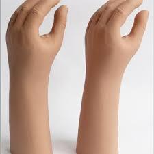 Silicone Hand Prosthesis at Orthotech Appliances

Address:
Orthotech Appliances,
Laxmi Nagar, East Delhi,
New Delhi-110092, Delhi, India

Product Overview:

The Silicone Hand Prosthesis is a highly advanced, realistic solution for individuals who have lost a hand due to injury, illness, or congenital conditions. Designed to provide both aesthetic restoration and functional benefits, the silicone hand prosthesis is crafted with premium-quality silicone material, ensuring a natural appearance, comfort, and durability. At Orthotech Appliances, we offer custom-designed silicone hand prostheses that cater to each individual’s unique needs, helping them regain their confidence and functionality in daily activities.

Key Features:

Realistic Appearance:
The silicone hand prosthesis is designed with intricate detail to closely resemble a natural hand, replicating the skin tone, texture, and anatomical features of the hand. This realistic look helps restore the wearer’s self-esteem and provides a more natural appearance.

Custom-Fit Design:
Each silicone hand prosthesis is individually customized to fit the unique dimensions of the wearer’s residual limb. This ensures the prosthesis is comfortable, secure, and functional for the user’s specific needs.

Lightweight & Flexible:
The silicone material is lightweight, making the prosthesis comfortable to wear throughout the day. Its flexible structure ensures natural movement and reduces discomfort, even during prolonged use.

Durable & Long-Lasting:
Crafted from high-quality silicone, the prosthesis is durable, offering long-lasting performance and resilience. It withstands daily wear and tear, ensuring continued functionality and comfort.

Comfortable & Skin-Friendly:
Silicone is a soft, skin-friendly material, making it ideal for extended use. The material is breathable, minimizing irritation and ensuring comfort, even during prolonged wear.

Easy Maintenance:
The silicone hand prosthesis is easy to clean and maintain. Regular cleaning and care ensure the prosthesis remains in excellent condition, maintaining both its function and appearance.

Indications:

Amputation or Limb Loss: Ideal for individuals who have lost a hand due to traumatic injury, disease, or congenital conditions, providing both functional and aesthetic restoration.
Cosmetic Restoration: For those seeking a cosmetic solution to restore the appearance of a natural hand, offering confidence and improving overall self-image.
Functional Needs: While primarily designed for cosmetic purposes, the silicone hand prosthesis can be functional for light daily tasks, offering limited hand movements or assisting in grip.
Post-Surgical Recovery: Helps individuals recovering from hand surgeries or injury, providing a realistic appearance while ensuring comfort during the healing process.
Why Choose Orthotech Appliances?

Expert Fitting & Design: Our experienced team at Orthotech Appliances specializes in custom silicone hand prostheses. We ensure the perfect fit and design tailored to your specific needs and preferences.
High-Quality Materials: We use only premium silicone material to create prostheses that are durable, realistic, and comfortable, enhancing both functionality and aesthetics.
Personalized Service: At Orthotech Appliances, we offer personalized consultations and fittings, guiding you through the process and ensuring you receive the best possible prosthetic solution.
Convenient Location: Located in Laxmi Nagar, East Delhi, our facility is easily accessible for fittings and consultations.
Visit Us Today!

For a realistic, comfortable, and functional Silicone Hand Prosthesis, visit Orthotech Appliances in Laxmi Nagar, East Delhi. Our team will work with you to create a custom solution that enhances your appearance, mobility, and quality of life.

For inquiries or more information, please contact us at:
Phone Number: [Insert Contact Number]
Email: [Insert Email Address]

Let us help you restore your natural look and feel with a Silicone Hand Prosthesis from Orthotech Appliances!