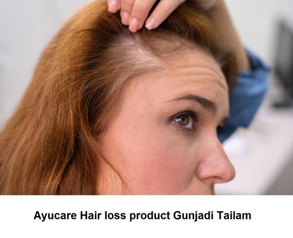 Ayurvedic shastrokt oil for hair loss especially in Alopecia mail or female
