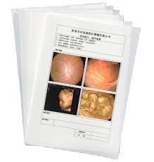 Inkjet X-Ray Films are an innovative and cost-effective solution for modern medical imaging needs. Designed with precision and quality, these films provide exceptional imaging clarity and compatibility with a variety of medical imaging modalities.Key Features:Premium Material: Manufactured using medical-grade PET base material with a thickness of 210 microns for durability and reliability.High-Quality Imaging: Features a single-sided inkjet coating that delivers superior quality prints, replacing traditional X-ray films and reducing costs for hospitals and patients.Versatile Compatibility: Supports imaging from multiple modalities, including CR, DR, MRI, CT-Scan, and Dental.Advanced Coating: Equipped with an antistatic back coating to prevent stickiness, ensuring smooth handling and operation.DICOM Software Integration: Built on Microsoft Dot Net technology and developed with licensed DICOM tools for enhanced imaging output.