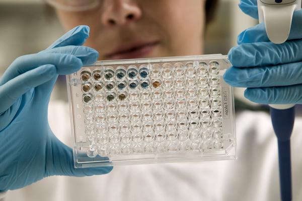 Pesticide analysis using Gas Chromatography–Mass Spectrometry (GC-MS) is a reliable technique for detecting and quantifying pesticide residues in food, water, soil, and environmental samples. The process separates pesticides based on their chemical properties and identifies them through their unique mass spectra. GC-MS offers high sensitivity, accuracy, and the ability to analyze multiple pesticide residues in a single run. This method is widely used for food safety testing, environmental monitoring, and regulatory compliance to ensure products meet international safety standards.