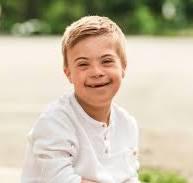 Downs Syndrome