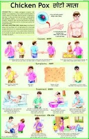 Chicken Pox (50x70cm) product image