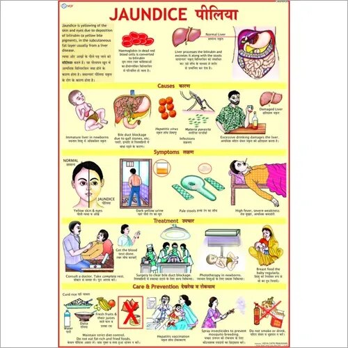Jaundice (50x70cm) product image